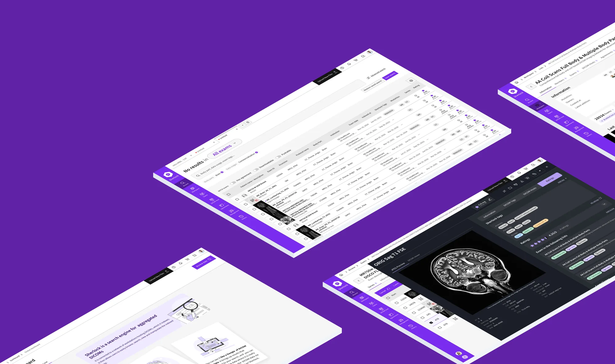 Écrans de l’interface Sherlock : recherche, tableaux de résultats et consultation des examens